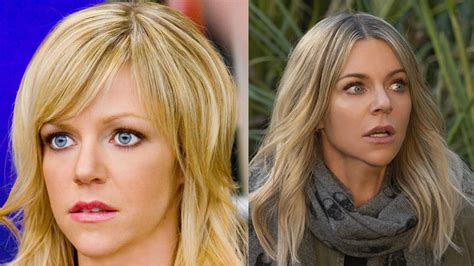 kaitlin olson mr skin|Kaitlin Olsons Plastic Surgery